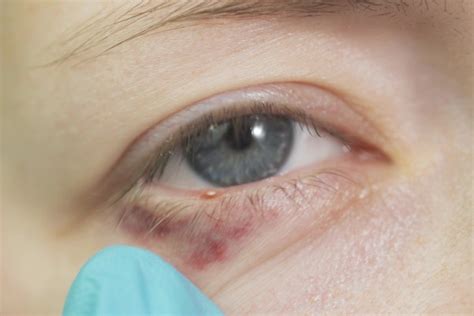 Tremedeira Nos Olhos O Que Pode Ser - Olhos tremendo - O que pode ser e quando tratar - MundoBoaForma