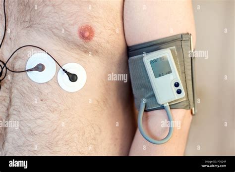 holter high resolution stock photography  images alamy
