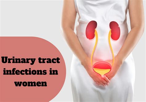 Female Urinary Infection Treatment at Matilda Neil blog