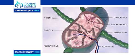 Lymph nodes removal surgery - Iranian Surgery