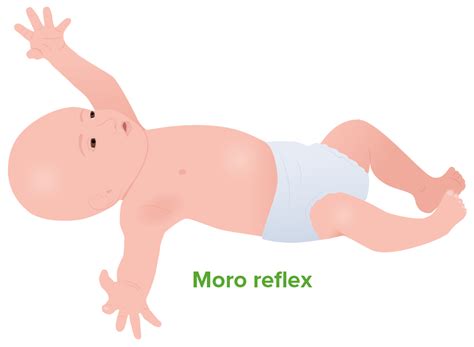 Moro Reflex Go Away at Mark Lenhardt blog