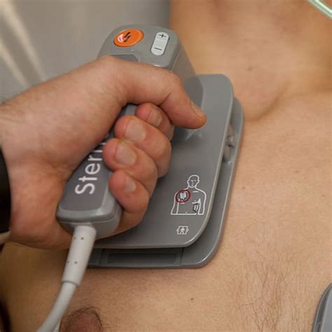 cardioversion dr matthew kahn