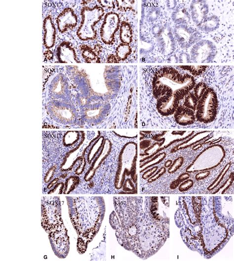 examples     combinations  sox  sox