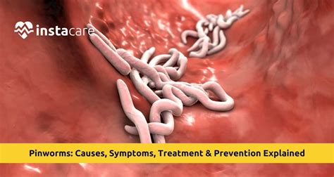 pinworms  humans medicine
