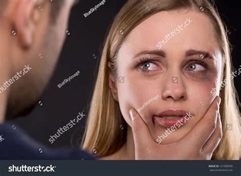 Close Up Of Crying Scared Female Face With Bruise. Man Holding Woman ...