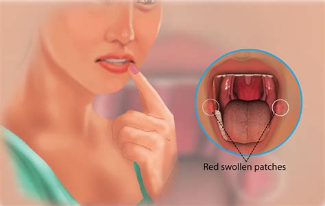 Health Symptoms : Causes, Treatment, Conditions and More