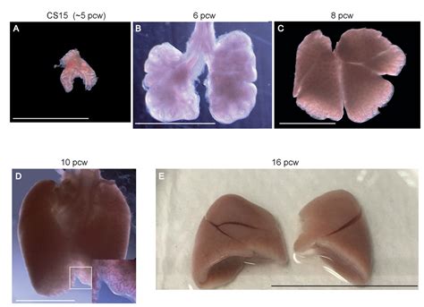 Figures and data in Human embryonic lung epithelial tips are ...