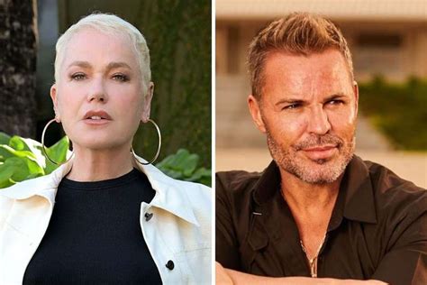 Eduardo Costa Parecendo A Xuxa - Famosos que Fizeram Transplante Capilar: Xuxa, Zezé e Mais Celebridades