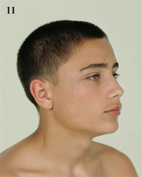 3 Signs Your Cut Is Deeper Than It Looks