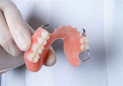 What You Need To Know About Denture Relines And Repairs