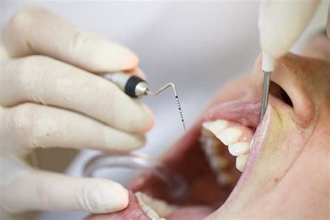 parodontologie dentaire au maroc clinique dentaire targa