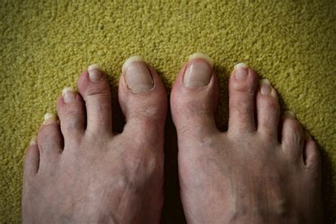 Long Toenails Images – Browse 46,776 Stock Photos, Vectors, and Video ...