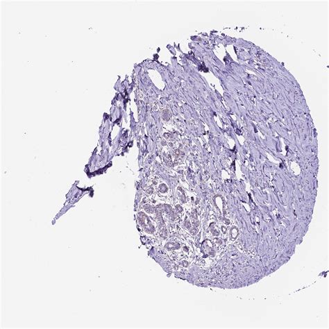 Tissue expression of EGFR - Staining in breast - The Human Protein Atlas