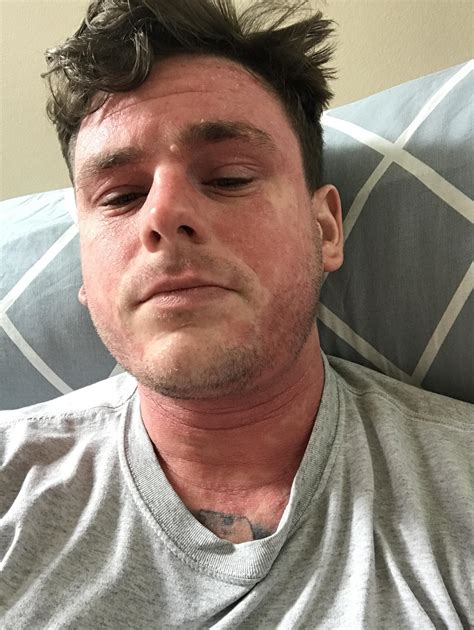 85 best Dupixent images on Pholder | Eczema, Ecze MA Bs and Commercials