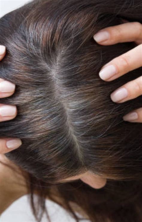 Common causes of premature grey hair