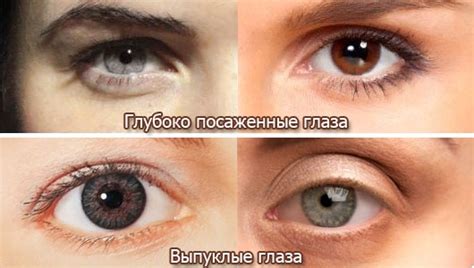 виды глаз у человека какие бывают