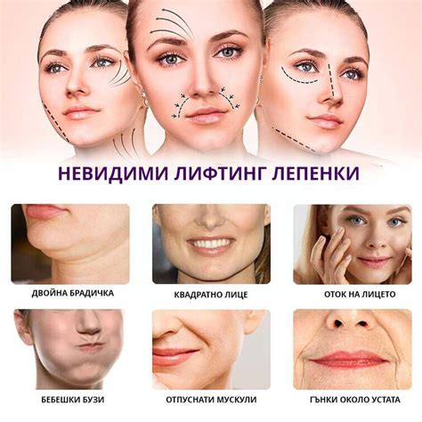 Лепенки за повдигане на лице, Лифтинг 40 броя
