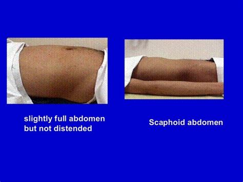 Final local abdominal examination 2