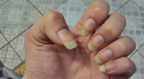 Porque A Unha Fica Amarela - Suas unhas estão ficando amarelas? Aqui estão 5 dicas para resolver ...