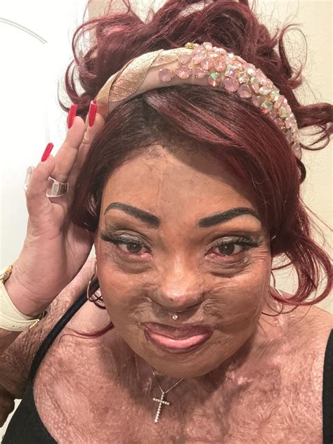 The post narcissist glow up is real! My case is extreme, but your life