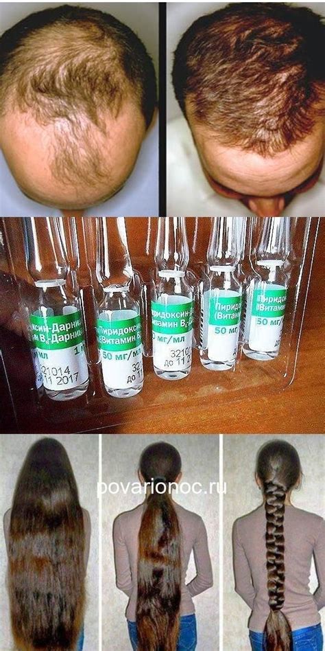 Копеечное средство для волос Best Beauty Tips, Beauty Hacks, Herbal ...