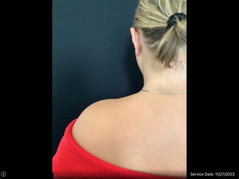 Traptox Review 2024: The Cost, Results, and Side Effects