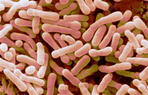 Bifidobacterium animalis - Stock Image - B220/1481 - Science Photo Library