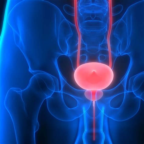 continuing education  managing neurogenic bladder