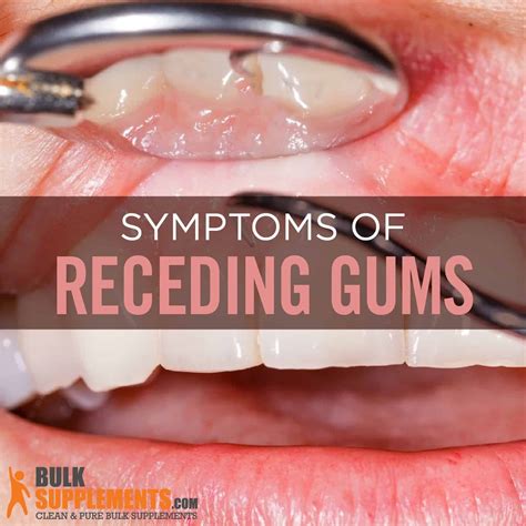 how to cure swollen gums