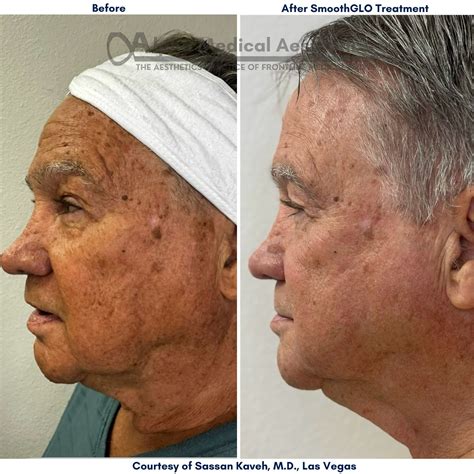 Alpha Medical Aesthetics - Medical Spa - Las Vegas, NV