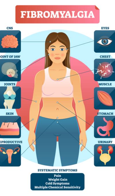 Fibromyalgia Symptoms