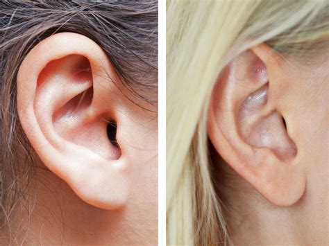 Celebrities With Attached Earlobes