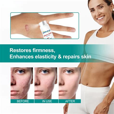 south moon custom logo  scar removal cream skin care stretch mark