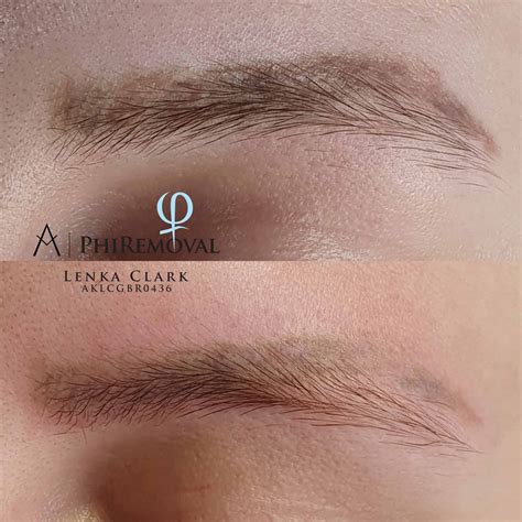 Gallery - Beauty Secret Cheltenham