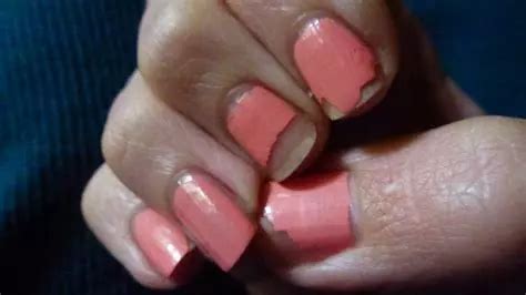 nail chipped | WordReference Forums