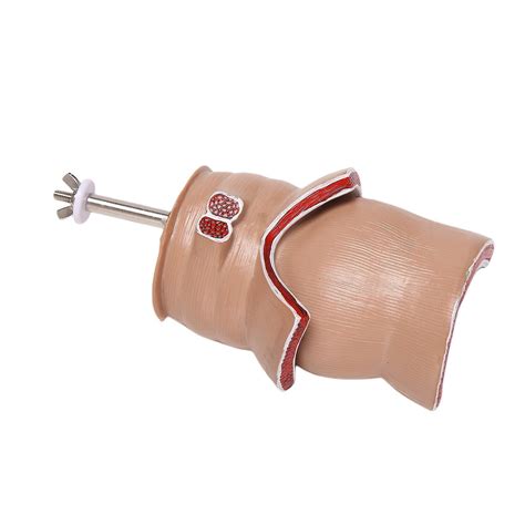 Anatomy model human rectal hemorrhoid lesion model hemorrhoid fistula