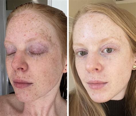 16 Drastic Transformation Pics That Prove Anything Is Possible / Bright ...