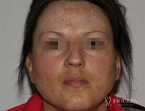 Personalized Skin Care Plan - Institut Figurra