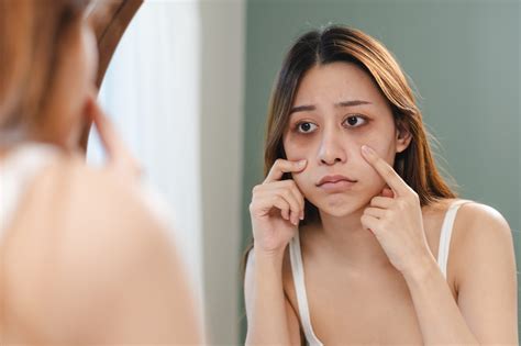 Are sleep disorders underdiagnosed in young people? | Tonic Media Network
