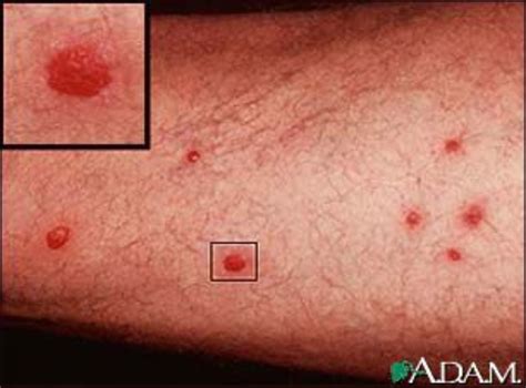 tiny red blood spots  skin austra health