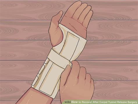 how long to recover from carpal tunnel surgery