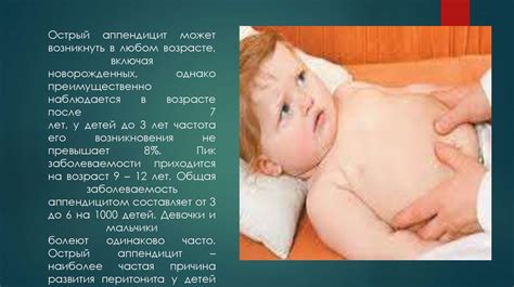 Острый аппендицит у детей - презентация онлайн