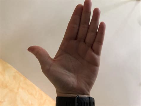 Is my middle fingers crooked : r/medical
