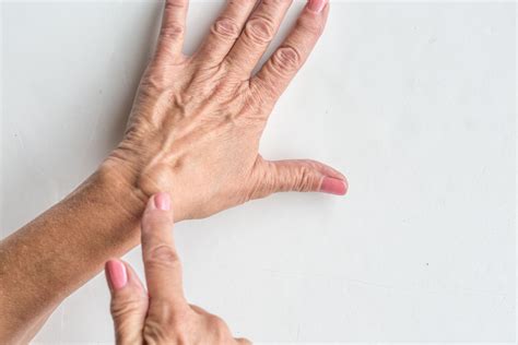 Ganglion nadgarstka – Chirurg ręki Szczecin