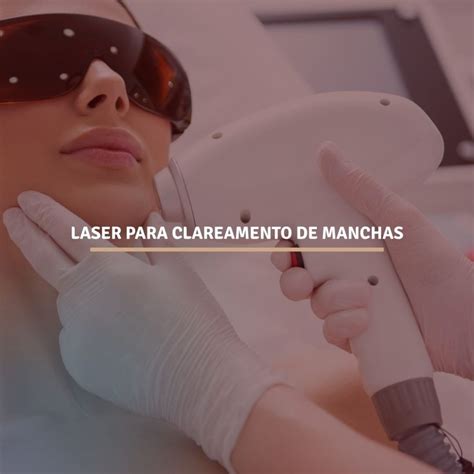Laser Para Clarear A Pele - Laser para clareamento de manchas - Clínica Skinlux