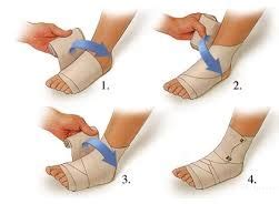 First aid - Sprain