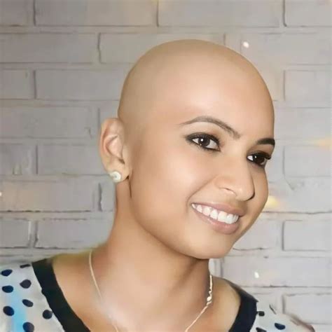 Bald is Beautiful: Empowering Women Worldwide