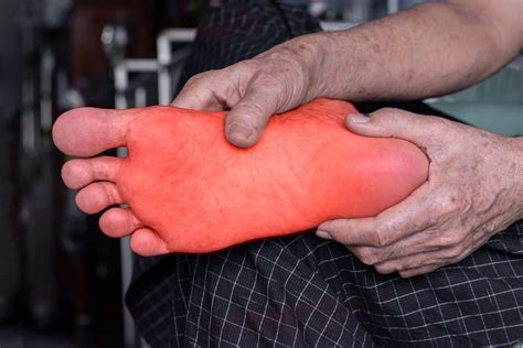 Understanding Common Causes of Foot Pain – KniseWorks