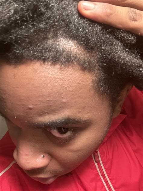 Discover more like BlackHair: Hol on… is this normal I have a front