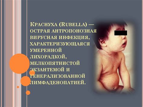 Вирус краснухи - презентация онлайн